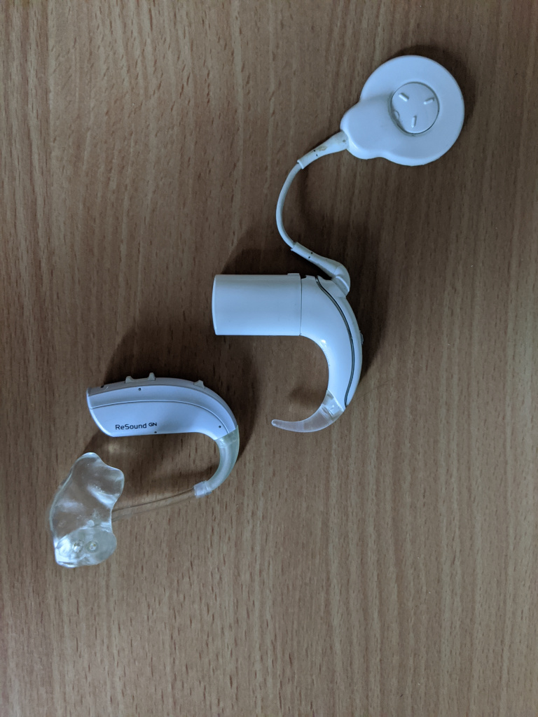 Cochlear Implant operation for better hearing